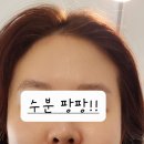 피움결에스테틱