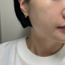 오 판소리(기초편) | 울트라클리어 레이저 가격 효과 모공 잘하는 병원 다녀온 후기