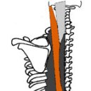 최장근(erector spinae - longissimus) 이미지