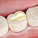 광명치과기공소 이미지