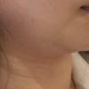 센텀해운대유치원 | 부산해운대센텀 리프팅 후기 인모드 만족도 높은 이유