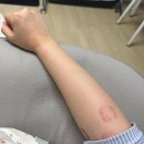 아라한의원 | [병원 일기] 검단 아라역 근처 한의원 추천/ 육아로 인한 손목 통증 치료 후기