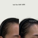 에이원헤어라인 이미지