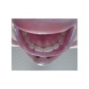 예닮치과병원 | 목포 예닮치과병원 비발치 치아교정 솔직 후기, 느낀 장단점