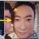 신비성형외과 이미지