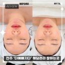 5873 | 전주 송천동 더예뻐지다에스테틱 웨딩관리 후기｜출산 후 붓기·비대칭까지 한 번에 관리