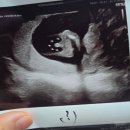 리움여성의원 이미지