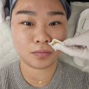 스킨22스튜디오뷰티교육센터 | 수성구스킨플래닝 매끈매끈 아기피부로 재탄생 뽐온뷰티 두산점 방문후기