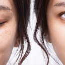 채피부과의원 이미지