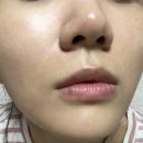 [폴사라] 줄기세포 엑소좀 앰플&amp; 콜라겐 병풀 진정 미스트 (줄기세포 앰플, 뿌리는 콜라겐)