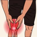 아작 이미지