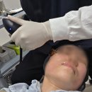 오푸스 | 청담피부과 예비 신부관리 오푸스 레이저리프팅 후기(통증,만족도,효과,가격)