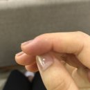 의림한의원 | [대구의림한의원] 2주 지난 후기