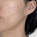 LA PLUIE 라플뤼 PDRN 엑소좀 앰플 2주 사용 찐후기 (피부과 스킨부스터를 집에서?)