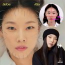 제일탑한의원 | '20분 만에 브이라인 완성' 관리의 신 40대 탑모델의 침 시술 비밀