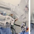 (개미뉴스) 인천세종병원, 국내 최초 ＜초고도비만 환자 대상 다빈치SP 단일공 담낭 로봇수술＞ 성공 이미지