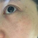 바이브 | 스킨바이브 가격 효과 후기