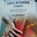 DNA 주사(1)-연골재생 이미지