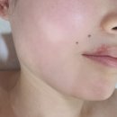 제니알 | [제니알 에스테틱] 인천 서창동ㅣ아프지 않은 윤곽관리! 서창동피부관리 찐후기