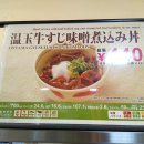 힘줄 이미지