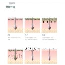 보떼드스파