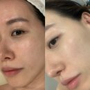 왕십리 피부관리 : 디유에스테틱 순환관리 웨딩관리 후기