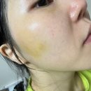 올리브영 1등 레티놀 아이오페 쎄럼 스킨부스터 사용기