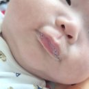 큐피드 | 3개월 아기 이앓이 준비 키즈마일 퍼기 큐피드 치발기 찐추천 후기