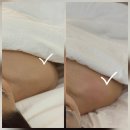 마포역(5) | 마포역 윤곽관리 [마이온스킨] 솔직후기 ☺️✨