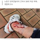 풀어놓은 대형견에 물려 발목신경 손상됐는데..견주 "보상 못해" 이미지