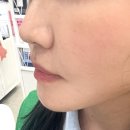 소나무약국 | 건조한피부 때문에 찾은 보습크림 | 솔아토24 카밍 모이스처 크림 솔직 후기