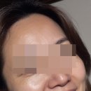 백옥 티스토리