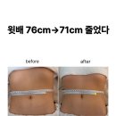 31140-6-76-10 | 천호동 피부샵 올가 드림뷰티 천호점 복부관리 후기, 윗배 76→71cm 1회 변화에 당황했다.