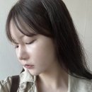 팔자주름 필러 시술 붓기 용량 뭉침 멍 후기