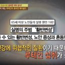 세이프아이 이미지