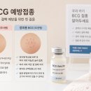 연세물푸레소아청소년과의원 | 별내 연세별가람소아청소년과의원 BCG 예방접종(경피용) 후기