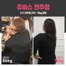 서전주정형외과 | 쥬비스전주점 방문상담 오시기 전, 이 글 하나면 준비 끝!