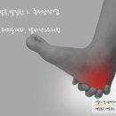 어울림병원 네이버블로그