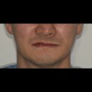 탄탄치과기공소 이미지