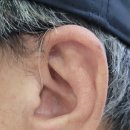 딜라이트보청기 광주점 이미지