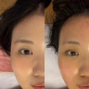 인스타그램 릴스 보고 찾아간 오드리에스떼 내돈내산후기 / 윤곽후기