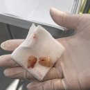 고릴라치과의원 이미지