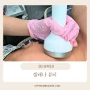 셀레나 | [마산 피부관리] 셀레나뷰티 윤곽곤리 리프팅 후기: 마이크로웨이브로 턱살 고민 해결!