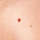 피부이야기 이미지