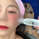 브리앙떼스킨케어 | 마포피부과 아디떼 ECM스킨부스터 adite 모공 관리 효과 후기