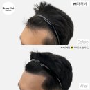 리미도트 네이버블로그
