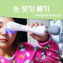 뷰티웰케어 | 송가인 림프마사지기 눈붓기빼기 닥터웰 뷰티웰 냉온마사지기 후기