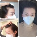 제이뷰티크 | 부산 해운대헤어라인 잘하는곳 제이뷰티크 후기 5살 어려졌데요!