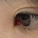 비비드 속눈썹 이미지