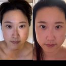 통일로768번길 | 고양동 수스킨케어 페이스관리 후기